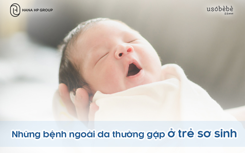 Cảnh báo: Những bệnh ngoài da thường gặp ở trẻ sơ sinh