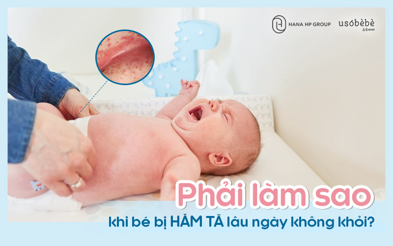 Bé bị hăm tã lâu ngày không khỏi - Mẹ phải làm gì?