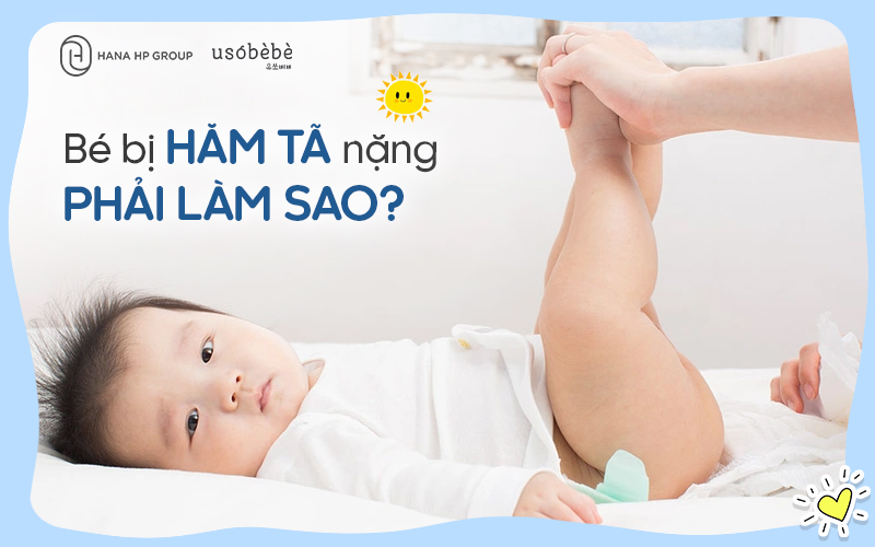 Bé bị hăm tã nặng phải xử lý ra sao?