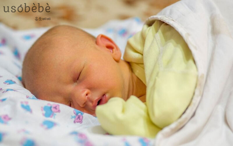 Bệnh vàng da ở bé