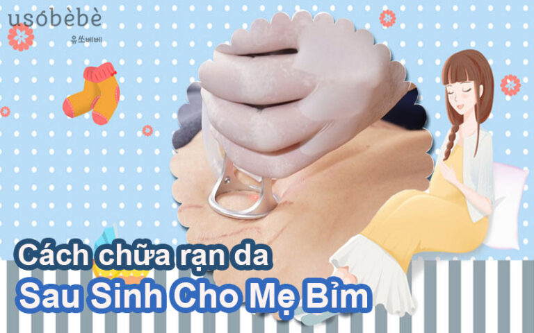 Tổng hợp các cách chữa rạn da sau sinh hiệu quả cho các Mom