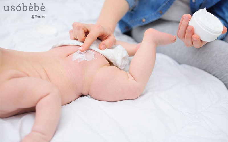 Điều trị Hăm tã và Rôm sảy an toàn mà hiệu quả