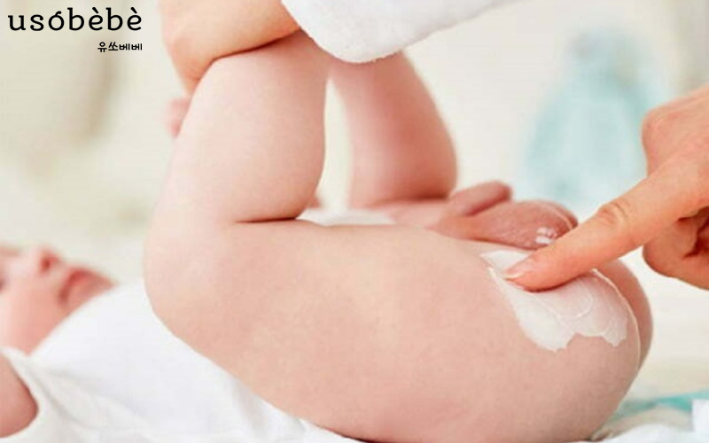 Sử dụng các loại kem bôi dược phẩm chuyên biệt lành tính