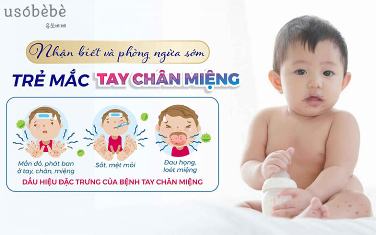 Cách phòng bệnh tay chân miệng cho trẻ mà Ba Mẹ cần biết?