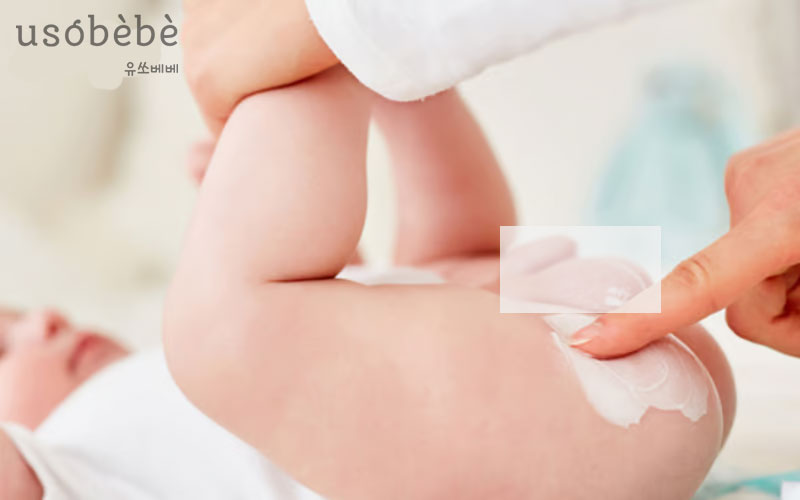 Dùng thuốc trị hăm cho bé