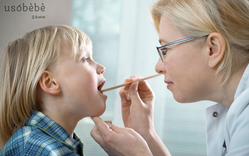 Bệnh viêm họng ở bé Bệnh viêm họng ở bé