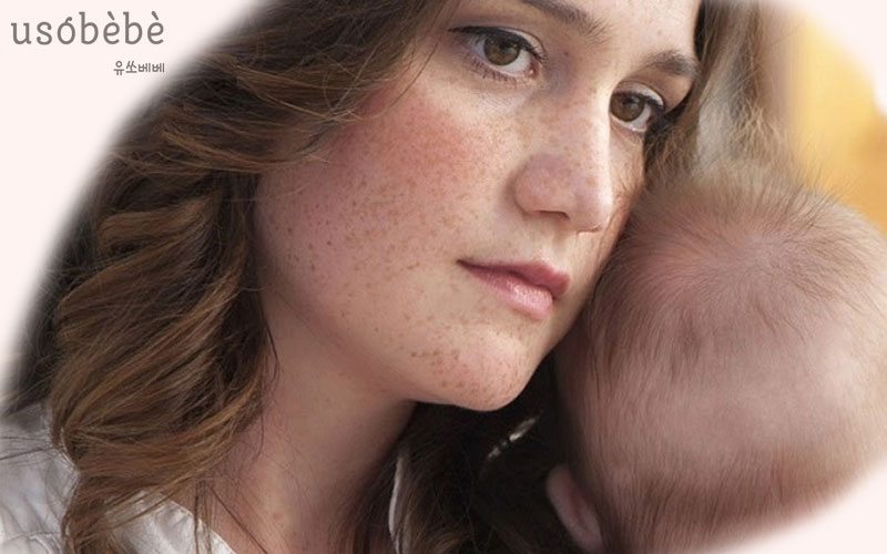 Da mặt Mẹ bỉm xuất hiện nám và tàn nhang sau khi sinh Da mặt Mẹ bỉm xuất hiện nám và tàn nhang sau khi sinh