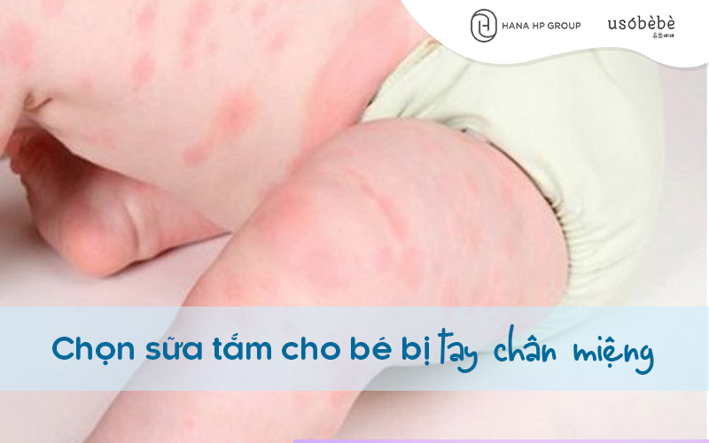 Chọn sữa tắm cho bé bị tay chân miệng cần chú ý gì?